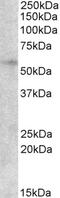 TPD52 Like 2 antibody, 45-455, ProSci, Immunohistochemistry paraffin image 