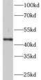 Peptidyl Arginine Deiminase 2 antibody, FNab06104, FineTest, Western Blot image 