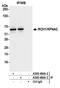 Karyopherin Subunit Alpha 2 antibody, A300-484A, Bethyl Labs, Immunoprecipitation image 