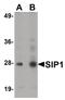 Gem Nuclear Organelle Associated Protein 2 antibody, PA5-20978, Invitrogen Antibodies, Western Blot image 