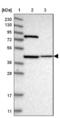 Dehydrogenase/Reductase 13 antibody, NBP1-81163, Novus Biologicals, Western Blot image 