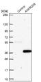 Ankyrin Repeat Domain 29 antibody, NBP2-30674, Novus Biologicals, Western Blot image 