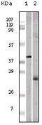 Apolipoprotein M antibody, GTX83082, GeneTex, Western Blot image 
