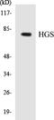 Hepatocyte Growth Factor-Regulated Tyrosine Kinase Substrate antibody, EKC1272, Boster Biological Technology, Western Blot image 