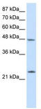Chromobox 6 antibody, TA343728, Origene, Western Blot image 