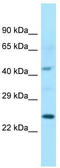 Isochorismatase Domain Containing 1 antibody, TA334313, Origene, Western Blot image 