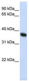 Ring Finger Protein 115 antibody, TA329840, Origene, Western Blot image 