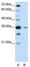 DAZ-associated protein 1 antibody, TA344016, Origene, Western Blot image 
