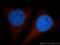 Glycogen Synthase 1 antibody, 10566-1-AP, Proteintech Group, Immunofluorescence image 