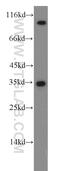Cyclin Dependent Kinase 1 antibody, 19532-1-AP, Proteintech Group, Western Blot image 