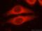 Thrombospondin 1 antibody, 18304-1-AP, Proteintech Group, Immunofluorescence image 