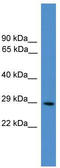 cAMP-dependent protein kinase catalytic subunit beta antibody, TA337695, Origene, Western Blot image 