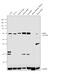 LIM Domain Kinase 1 antibody, PA5-14938, Invitrogen Antibodies, Western Blot image 