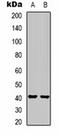 Hydroxyacid oxidase 1 antibody, orb323150, Biorbyt, Western Blot image 