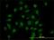 Homeodomain-interacting protein kinase 1 antibody, H00204851-M07, Novus Biologicals, Immunocytochemistry image 