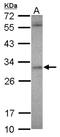 Ankyrin Repeat And SOCS Box Containing 12 antibody, NBP2-15480, Novus Biologicals, Western Blot image 