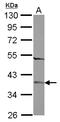 Zinc Finger C2HC-Type Containing 1A antibody, LS-C155657, Lifespan Biosciences, Western Blot image 