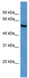 FTO Alpha-Ketoglutarate Dependent Dioxygenase antibody, TA342384, Origene, Western Blot image 