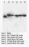 DNA nucleotidylexotransferase antibody, AP23384PU-N, Origene, Western Blot image 