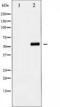Yes Associated Protein 1 antibody, TA325981, Origene, Western Blot image 