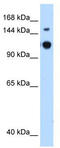 GTPase Activating Protein And VPS9 Domains 1 antibody, TA344118, Origene, Western Blot image 