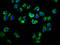 Adhesion G Protein-Coupled Receptor E2 antibody, LS-C680134, Lifespan Biosciences, Immunofluorescence image 