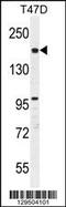 Forkhead Associated Phosphopeptide Binding Domain 1 antibody, 55-838, ProSci, Western Blot image 