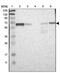 NFI-A antibody, PA5-52622, Invitrogen Antibodies, Western Blot image 