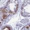 MAGE Family Member B6 antibody, NBP1-84353, Novus Biologicals, Immunohistochemistry frozen image 
