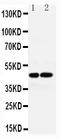 Arginine Vasopressin Receptor 1A antibody, LS-C313522, Lifespan Biosciences, Western Blot image 