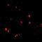 Ceramide Synthase 5 antibody, orb75024, Biorbyt, Immunofluorescence image 