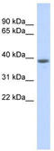 DDB1 And CUL4 Associated Factor 4 Like 1 antibody, TA334962, Origene, Western Blot image 