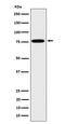 Dipeptidyl Peptidase 3 antibody, M07788-1, Boster Biological Technology, Western Blot image 