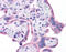 WT1 Transcription Factor antibody, ARP37989_P050, Aviva Systems Biology, Immunohistochemistry paraffin image 