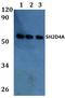 SH2 Domain Containing 4A antibody, A09094, Boster Biological Technology, Western Blot image 