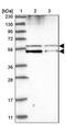 ATPase H+ Transporting V1 Subunit B1 antibody, PA5-56878, Invitrogen Antibodies, Western Blot image 