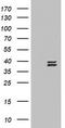 Ornithine Carbamoyltransferase antibody, TA802692S, Origene, Western Blot image 