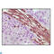 Vimentin antibody, LS-C814258, Lifespan Biosciences, Immunohistochemistry paraffin image 