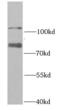 E3 ubiquitin-protein ligase RAD18 antibody, FNab07075, FineTest, Western Blot image 