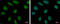 DNA replication licensing factor MCM6 antibody, GTX129218, GeneTex, Immunocytochemistry image 