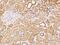 Mitochondrial Ribosomal Protein L23 antibody, 205916-T10, Sino Biological, Immunohistochemistry paraffin image 