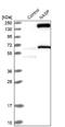 Nuclear Autoantigenic Sperm Protein antibody, NBP2-33910, Novus Biologicals, Western Blot image 