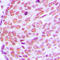 Lamin A/C antibody, LS-C352470, Lifespan Biosciences, Immunohistochemistry paraffin image 