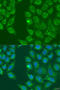 Hydroxysteroid 17-Beta Dehydrogenase 3 antibody, 23-107, ProSci, Immunofluorescence image 