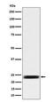 ADP Ribosylation Factor Related Protein 1 antibody, M08327, Boster Biological Technology, Western Blot image 