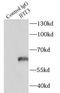 Interferon Induced Protein With Tetratricopeptide Repeats 3 antibody, FNab04138, FineTest, Immunoprecipitation image 