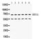 HERV-R_7q21.2 provirus ancestral Env polyprotein antibody, RP1091, Boster Biological Technology, Western Blot image 