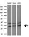 Pyrroline-5-Carboxylate Reductase 3 antibody, M32428-1, Boster Biological Technology, Western Blot image 