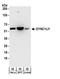 Cytoplasmic dynein 1 light intermediate chain 1 antibody, A304-208A, Bethyl Labs, Western Blot image 