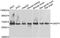 Beta-Ala-His dipeptidase antibody, A7485, ABclonal Technology, Western Blot image 